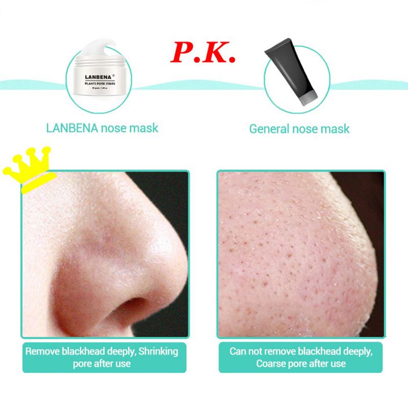 Blackhead Remover Skin Care Cream Deep Clean Removal + Nose Pore Strips